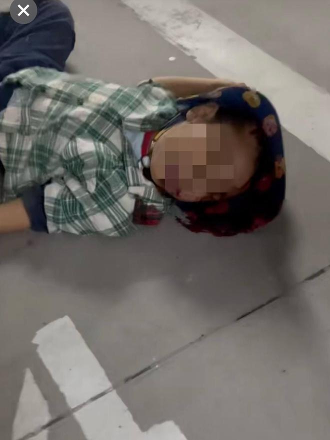 小区暗藏“吃人”竖井:天津两男童从6米高处坠落,一人重伤开颅昏迷已10天丨极目调查